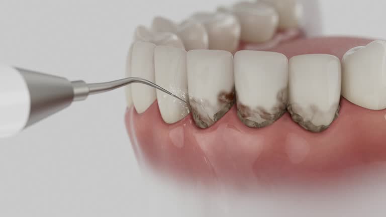 Trusted Emergency Dentist service in Fayetteville, PA - Dentist Open Now